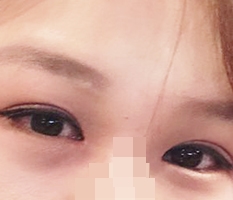 현대미학베스트셀피