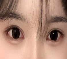 현대미학베스트셀피